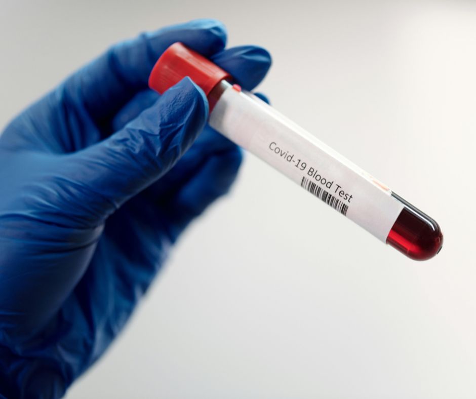 COVID-19 PCR & Antibody Tests
